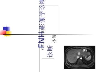 FNH影像学诊断及鉴别诊断
