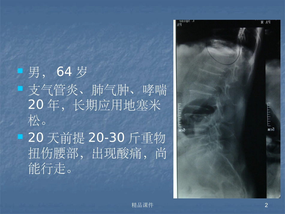 kummell病_第2页