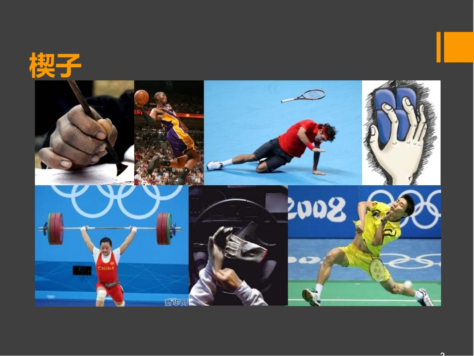 TFCC损伤课件_第2页