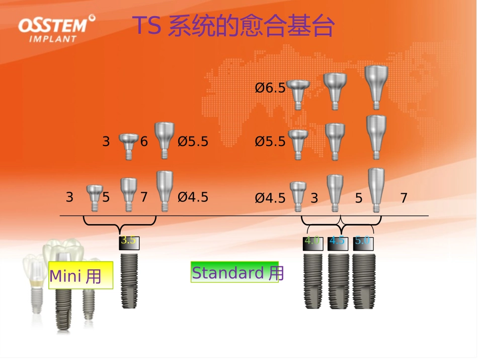 奥齿泰修复取模分析_第3页