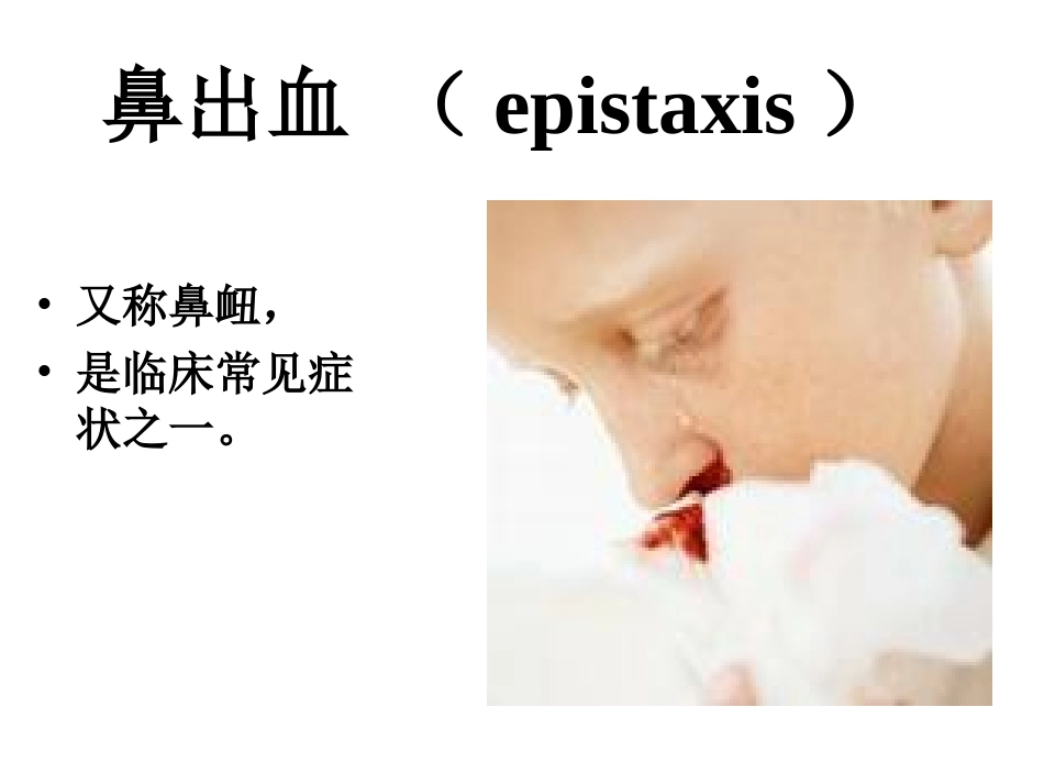 鼻出血部位的评估_第2页