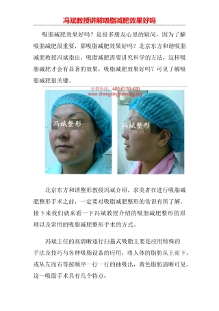 吸脂减肥效果好吗