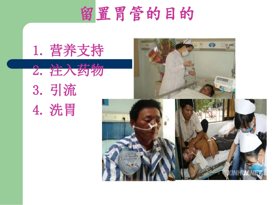 鼻胃管的护理_第2页