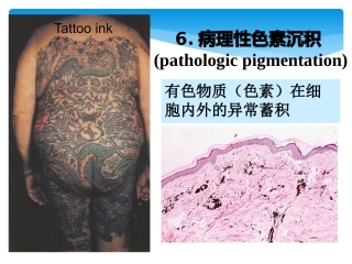 病理学细胞死亡