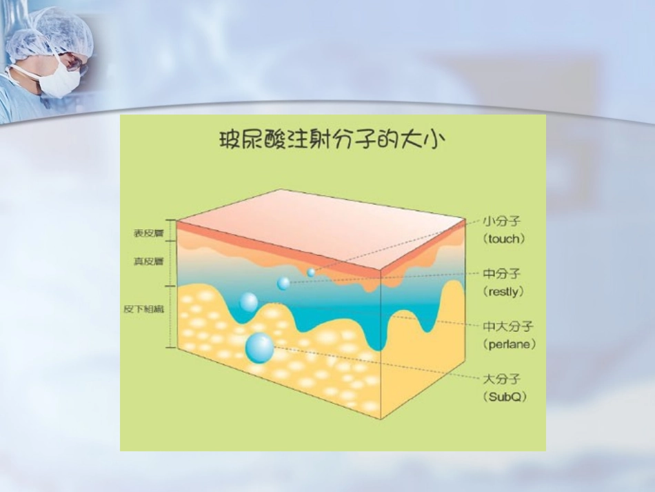 玻尿酸的注射技巧-医学课件_第3页