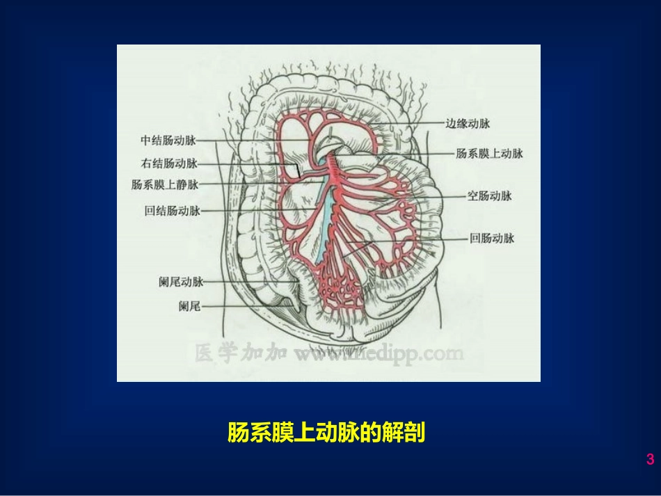 肠系膜上动脉狭窄的腔内治疗概要_第3页