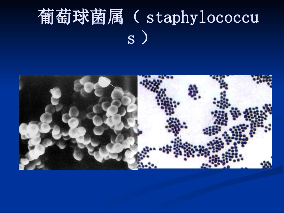常见病原性细菌_第3页