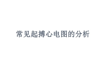 常见起搏心电图的分析课件