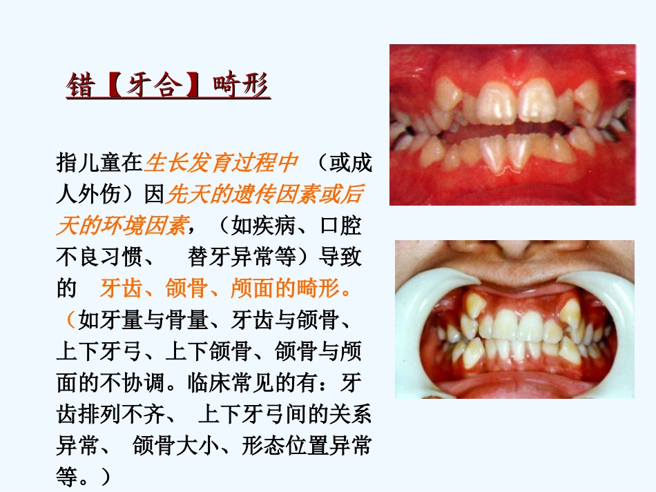 错颌畸形的病因_第2页