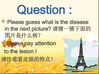 带状疱疹课件