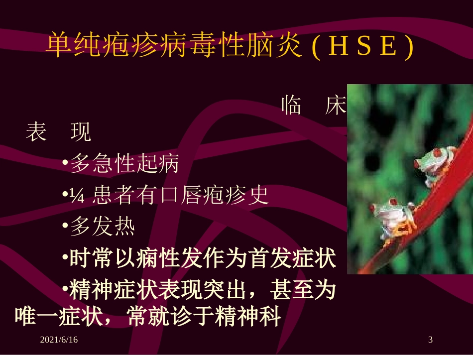 单纯疱疹病毒性脑炎_第3页