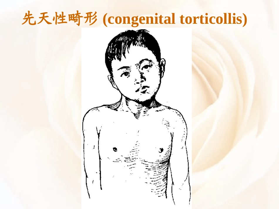 第九版外科学运动系统畸形_第3页