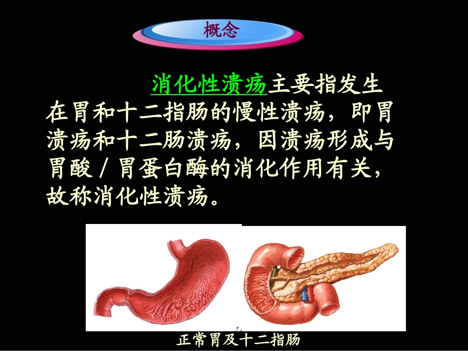 第三节消化性溃疡病人的护理_第2页