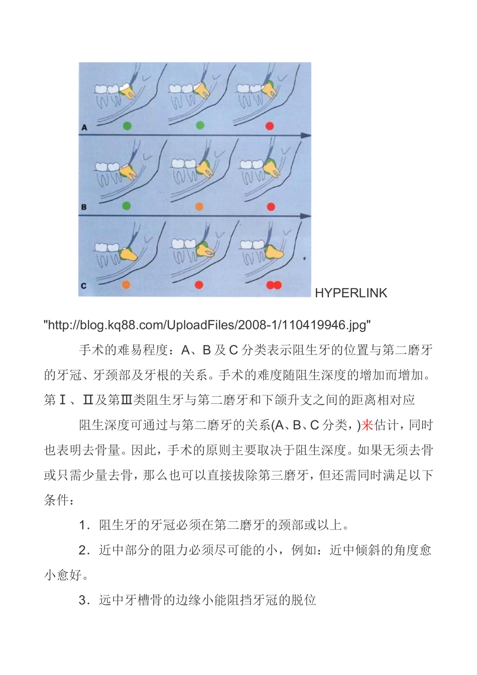 各种阻生牙的处理方法_第3页