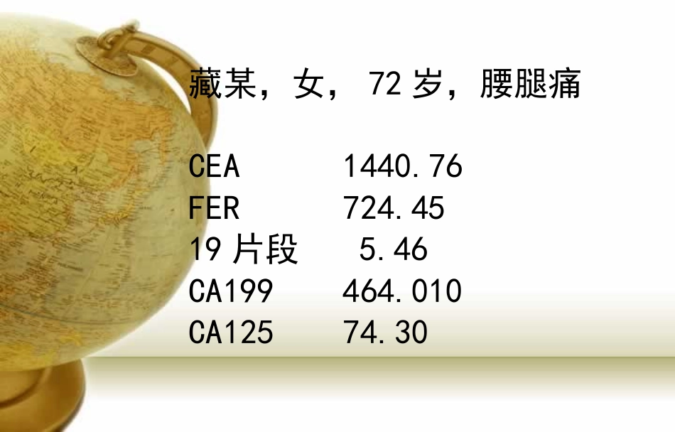 多发性肿瘤骨转移诊断与治疗_第2页