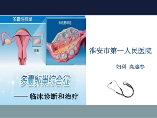 多囊卵巢综合征