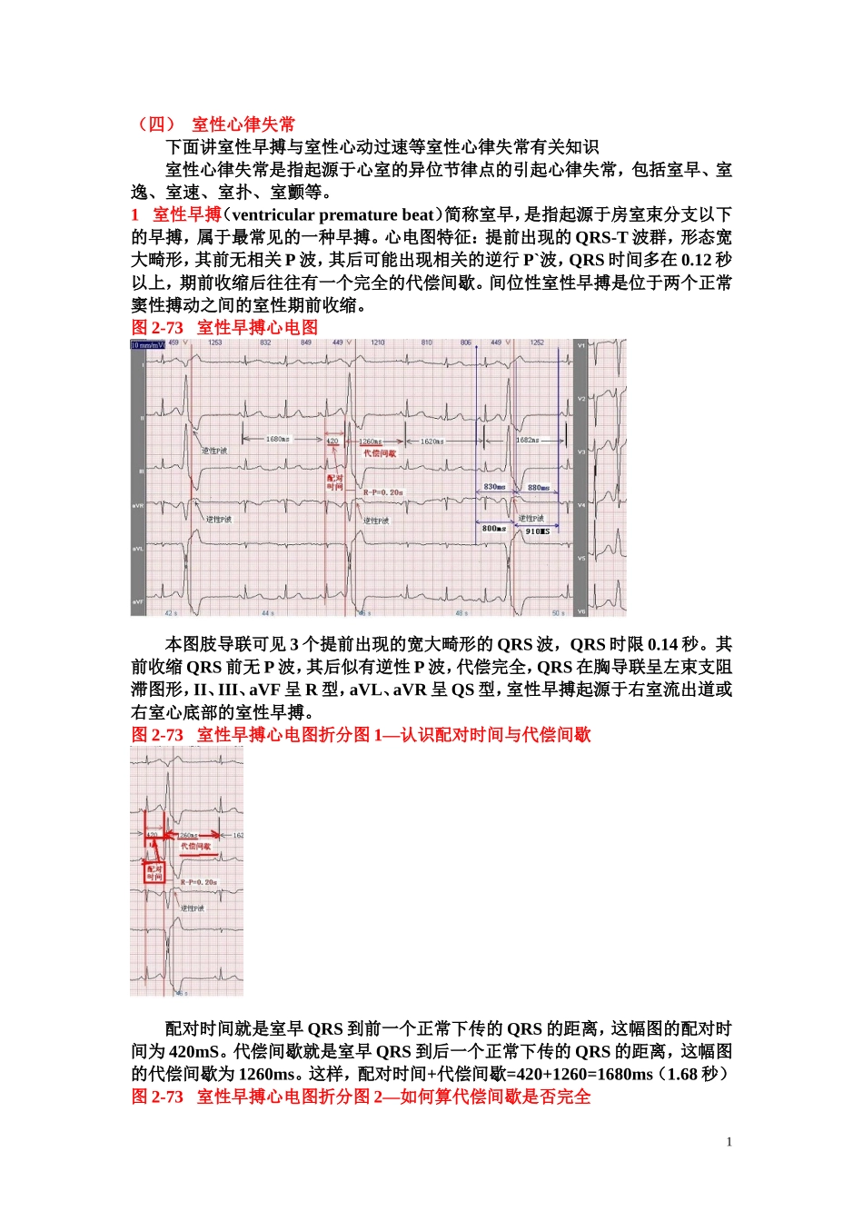 另类心电图讲义-4---室性心律失常-2_第1页