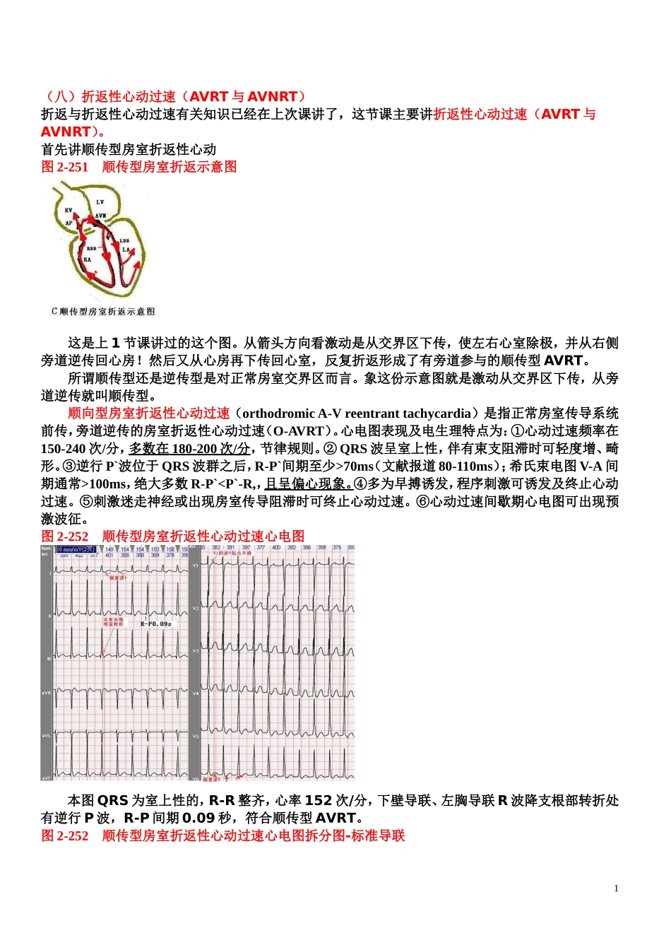 另类心电图讲义-8---折返性心律失常_第1页