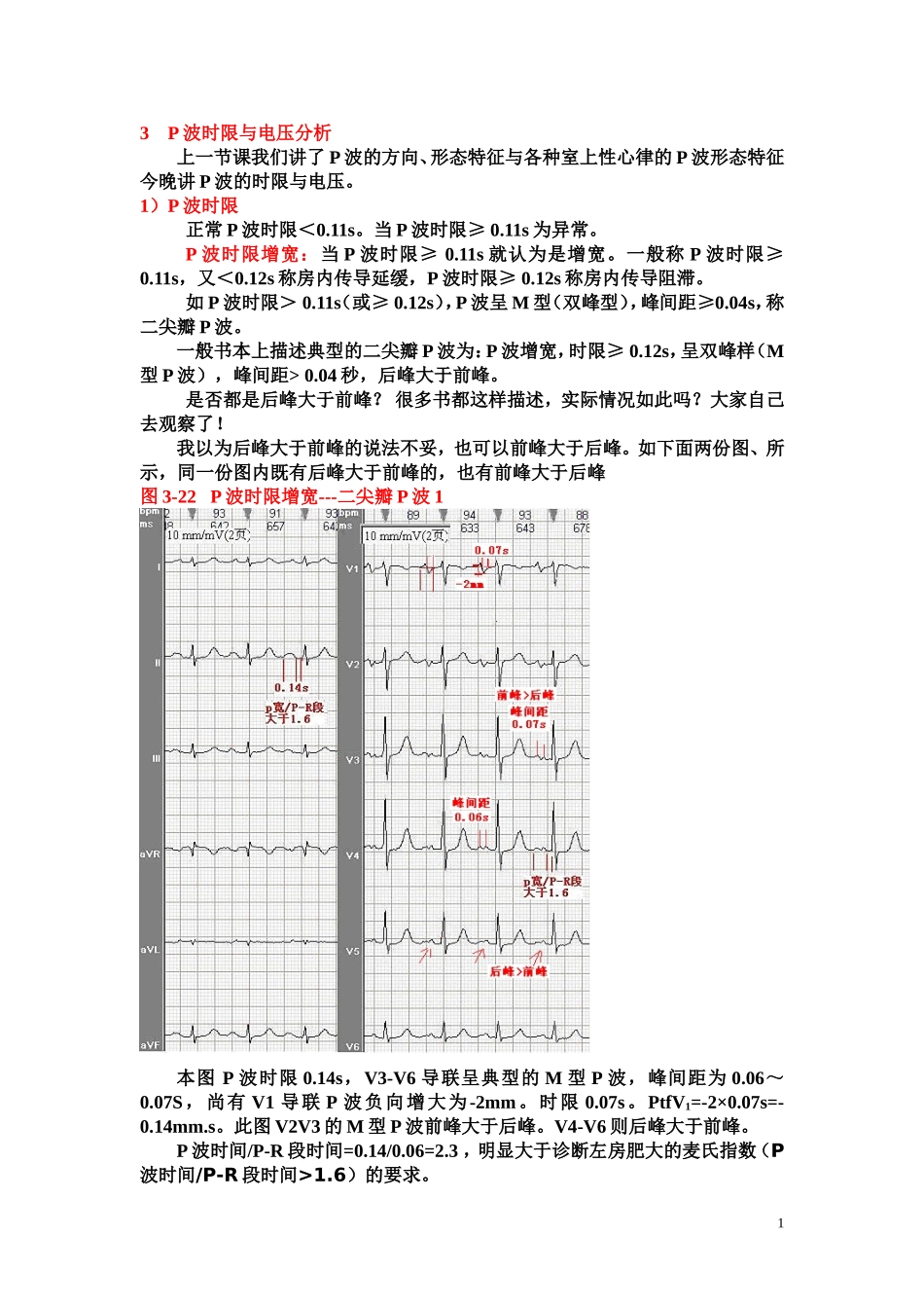 另类心电图学讲义4--P波时限与电压_第1页