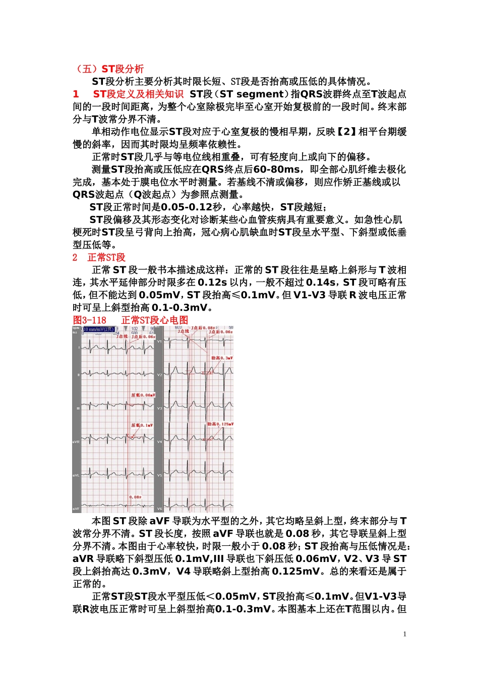 另类心电图学讲义9--ST段分析_第1页