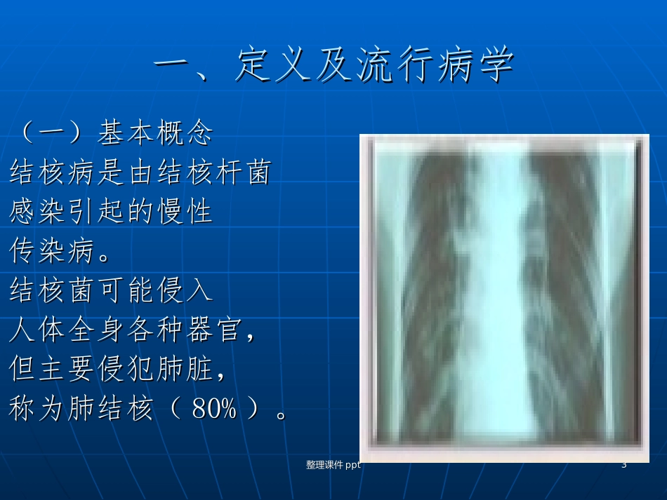 肺结核防治知识_第3页