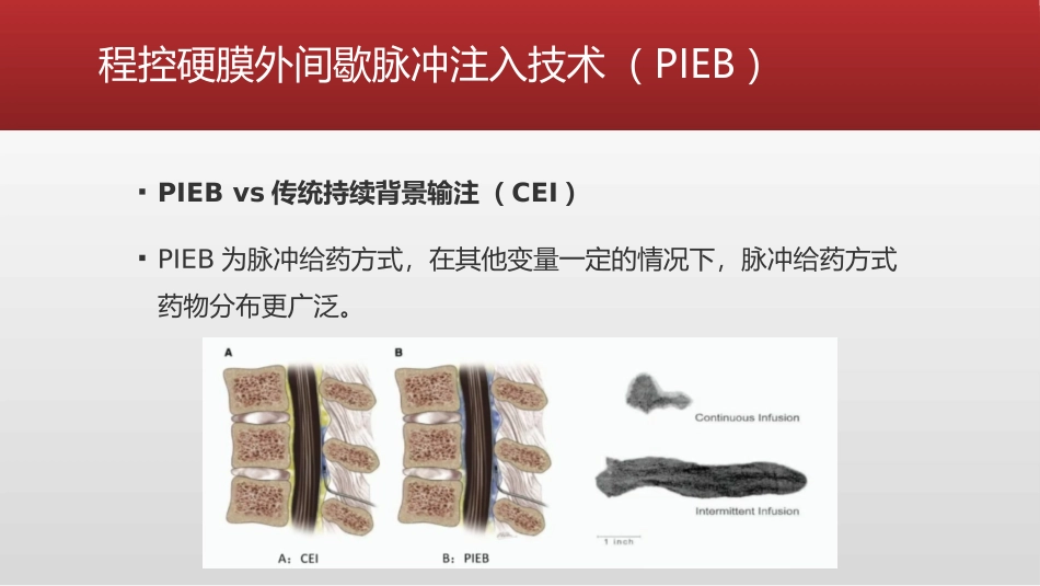 分娩镇痛的进展及热点_第2页