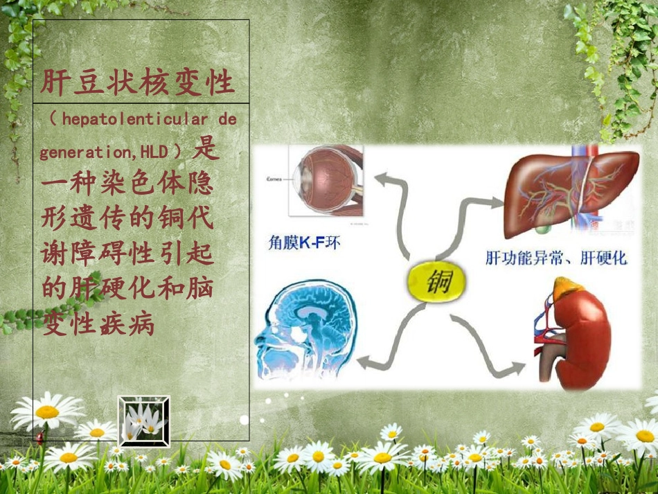 肝豆状核变性护理_第3页