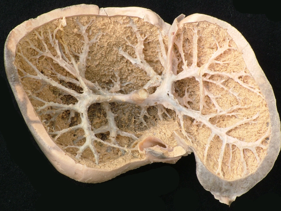 肝内门静脉和肝静脉解剖及多层螺旋CT_第3页