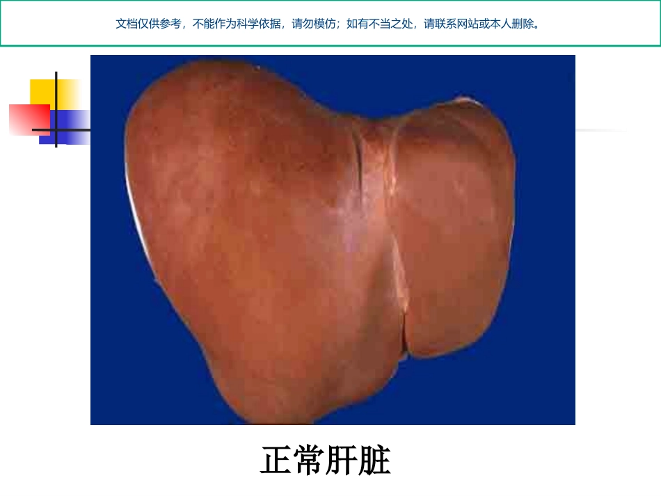 肝硬化腹水病人的护理课件_第3页