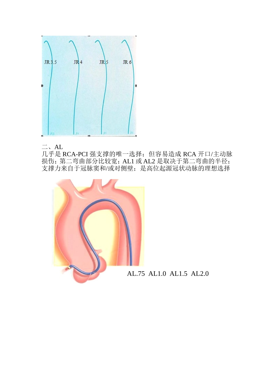 右冠状动脉指引导管的选择_第2页