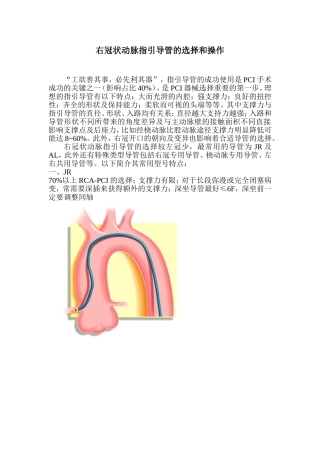 右冠状动脉指引导管的选择