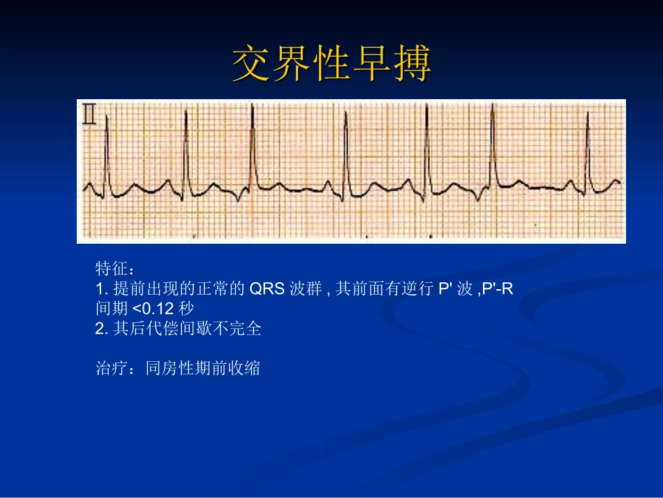 各种心律失常典型心电图_第3页