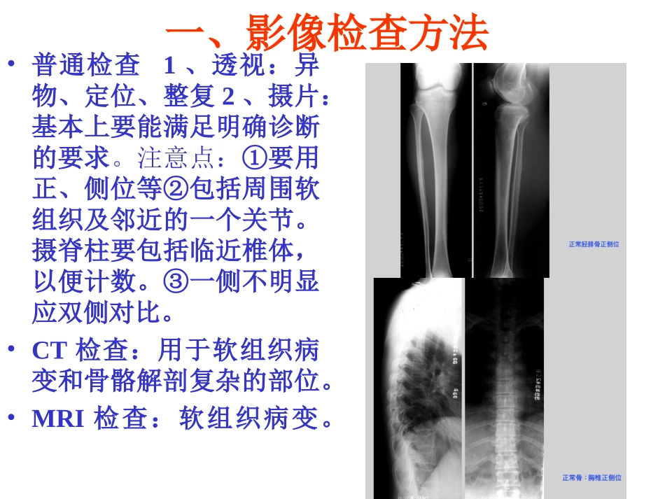 骨关节系统影像表现及诊断_第2页