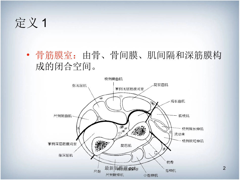 骨筋膜室综合征课件_第2页
