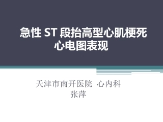 急性ST段抬高型心肌梗死心电图表现