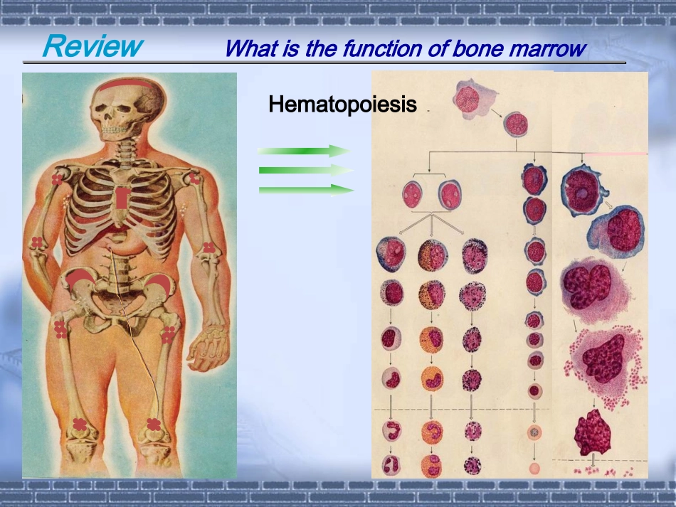 急性白血病课件_第2页