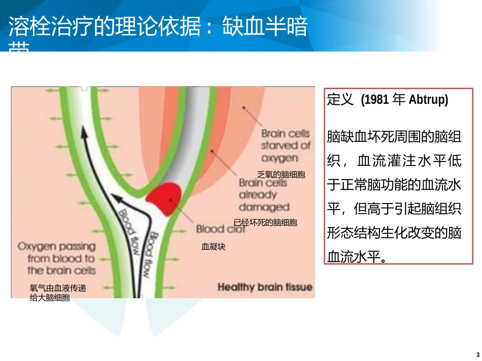 急性缺血性卒中的静脉溶栓治疗_第3页