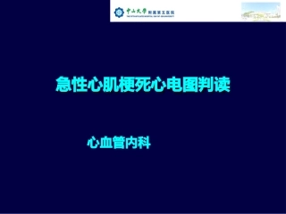 急性心肌梗死心电图判读