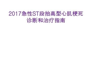 急性心肌梗死治疗指南