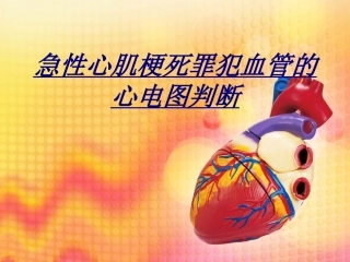 急性心肌梗死罪犯血管的心电图判断讲义