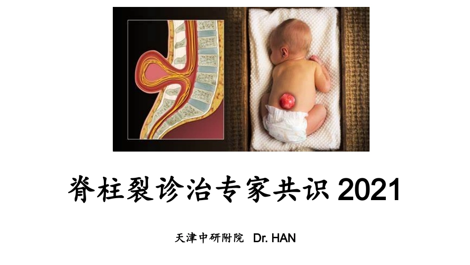 脊柱裂诊治专家共识_第1页