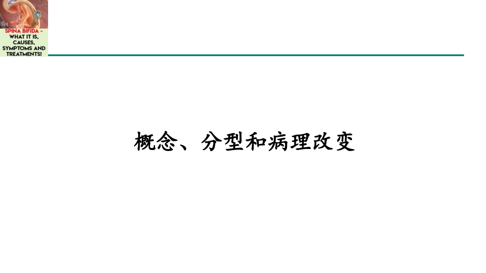 脊柱裂诊治专家共识_第3页