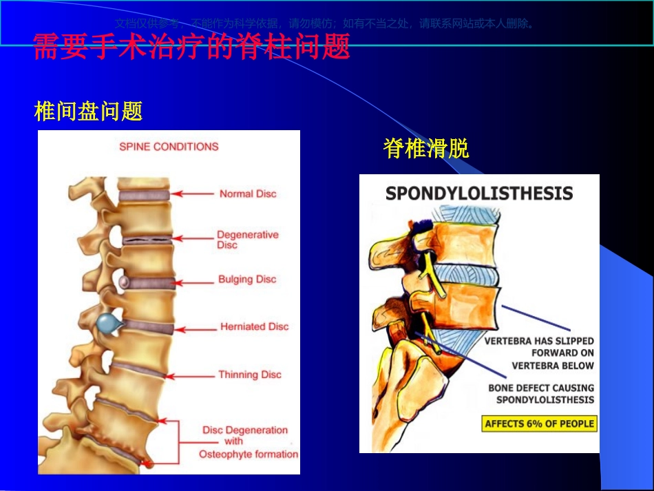 脊柱手术的麻醉课件_第1页