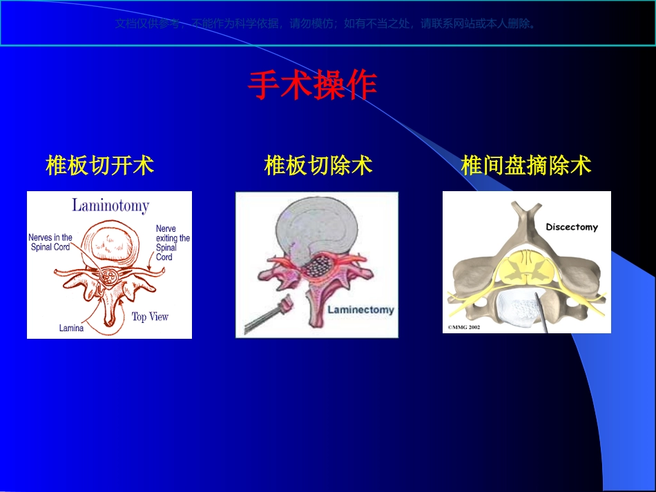脊柱手术的麻醉课件_第3页