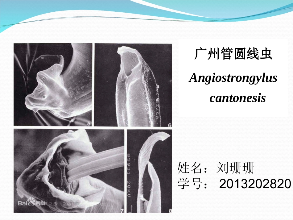 寄生虫广州管圆线虫讲解_第1页