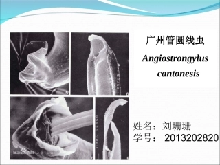 寄生虫广州管圆线虫讲解