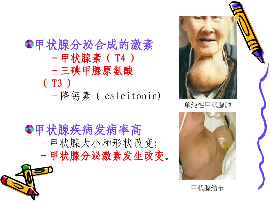 甲状腺肿大上课_第3页