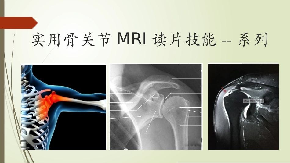 肩关节骨片技能_第1页
