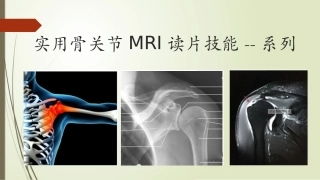 肩关节骨片技能