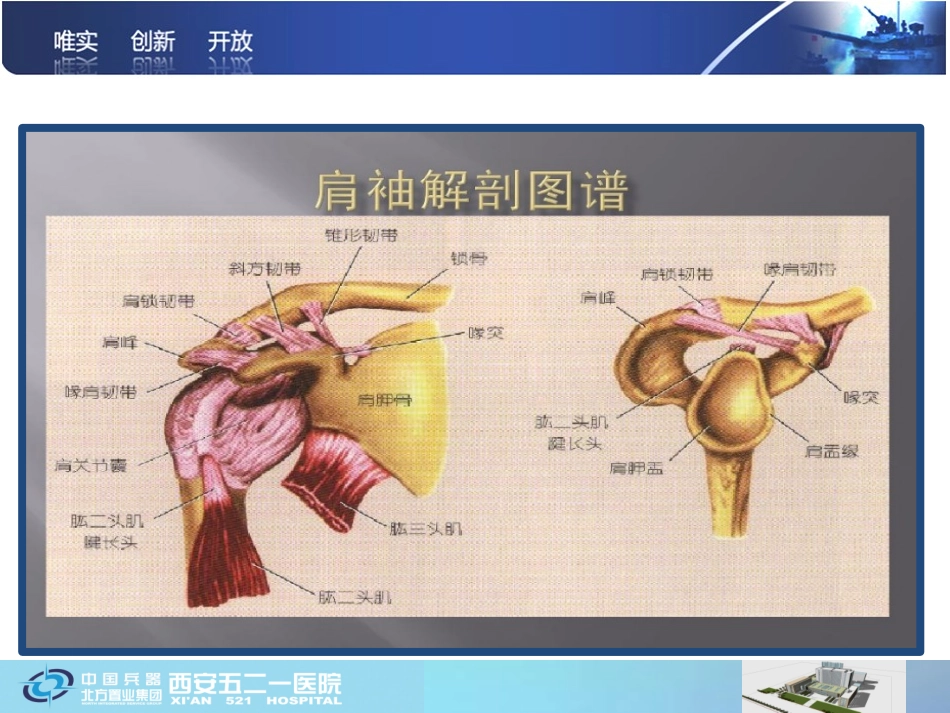肩袖断裂修补_第3页